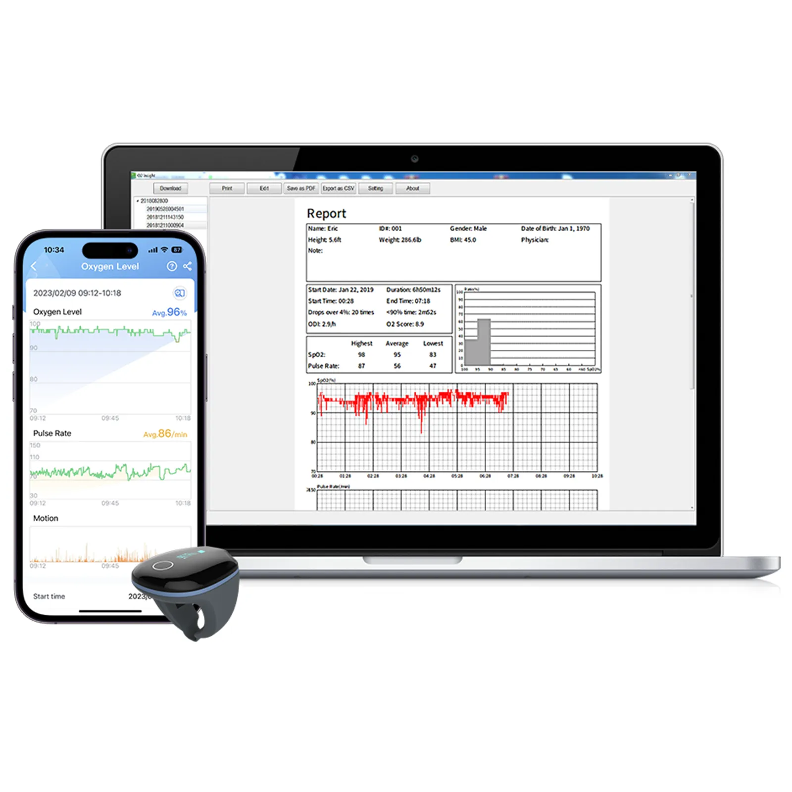 O2Ring™ Continuous Ring Oxygen Monitor